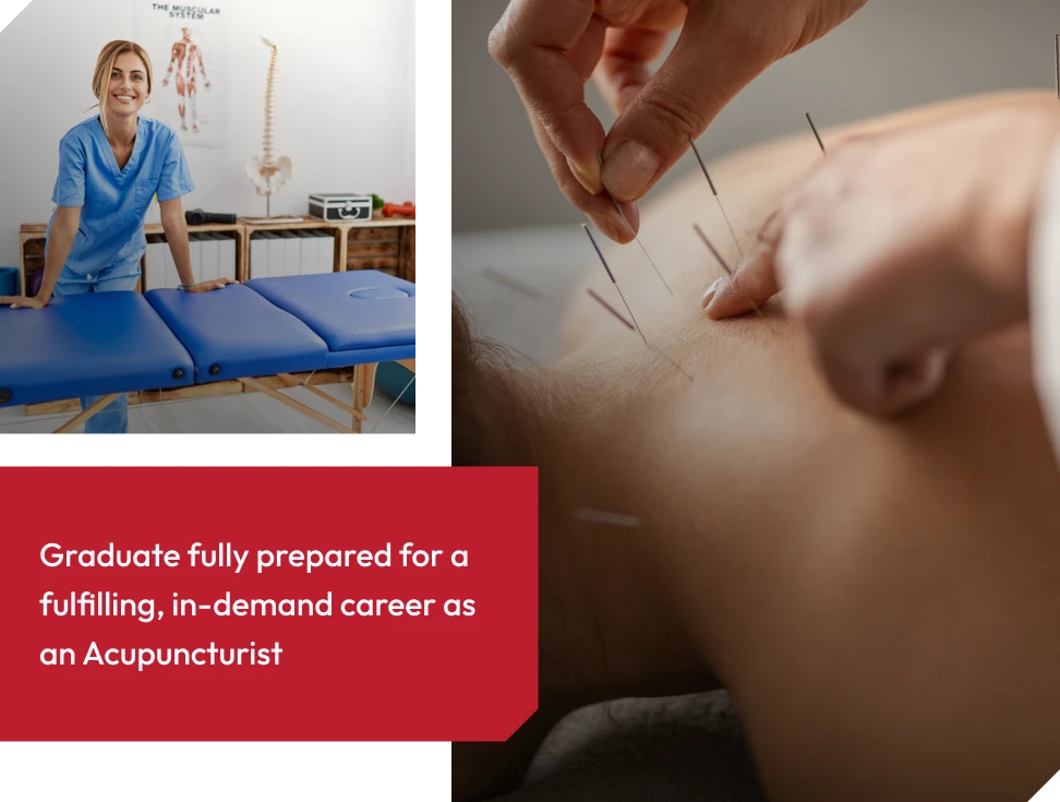 Acupuncture career paths